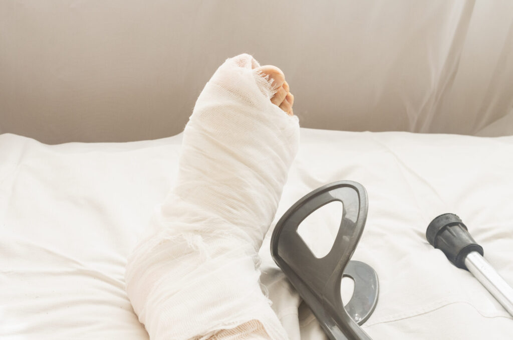 Prawnik ocenia okoliczności poślizgnięcia w przestrzeni publicznej